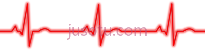 心电图,ekg PNG